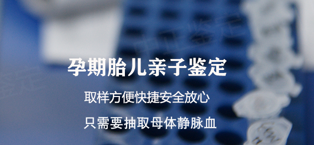 浙江产前亲子鉴定哪里能做,